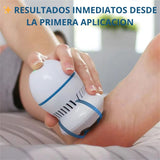 REMOVEDOR INTELIGENTE DE CALLOS EN LOS PIES | ENVIO GRATIS